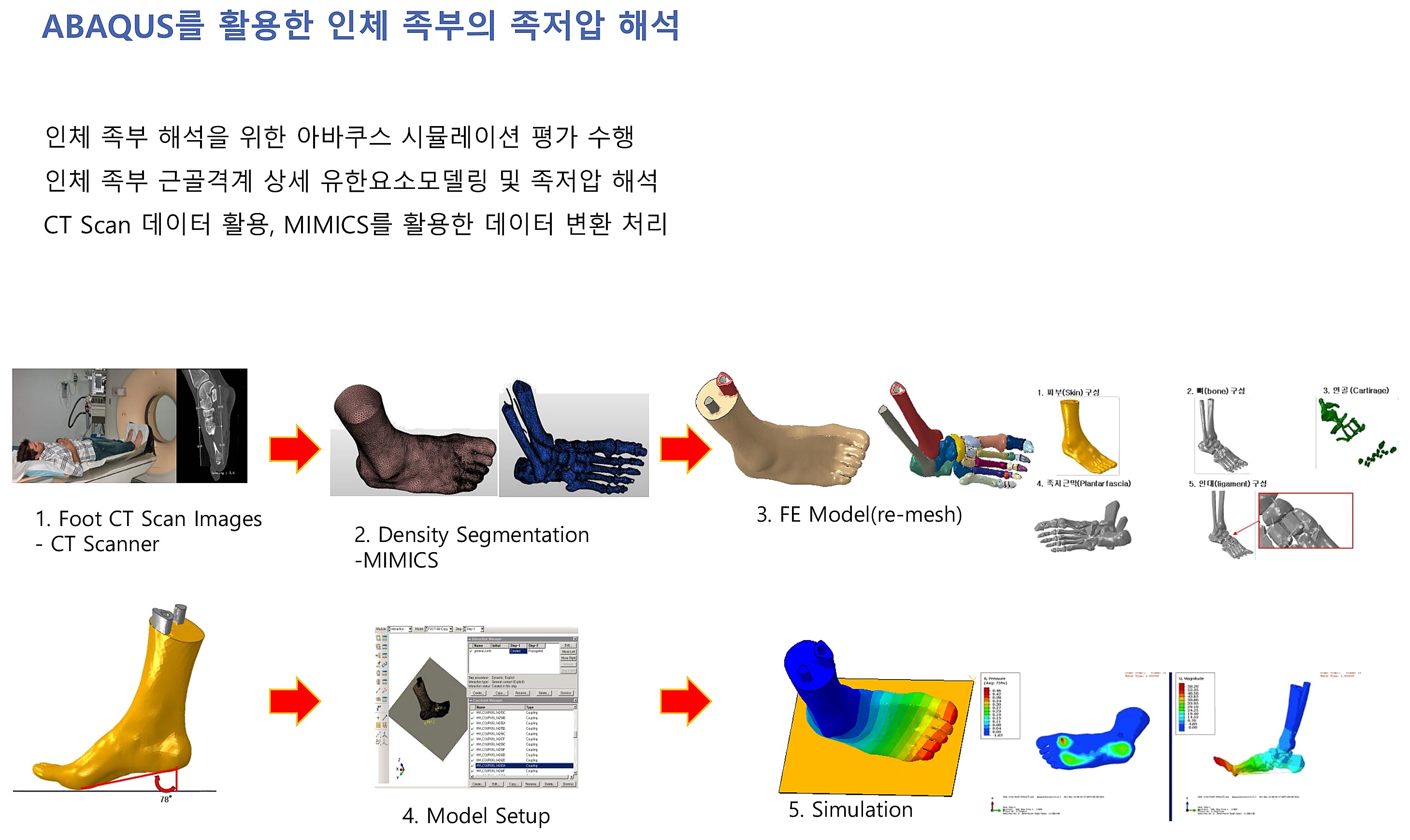 족저압 해석
