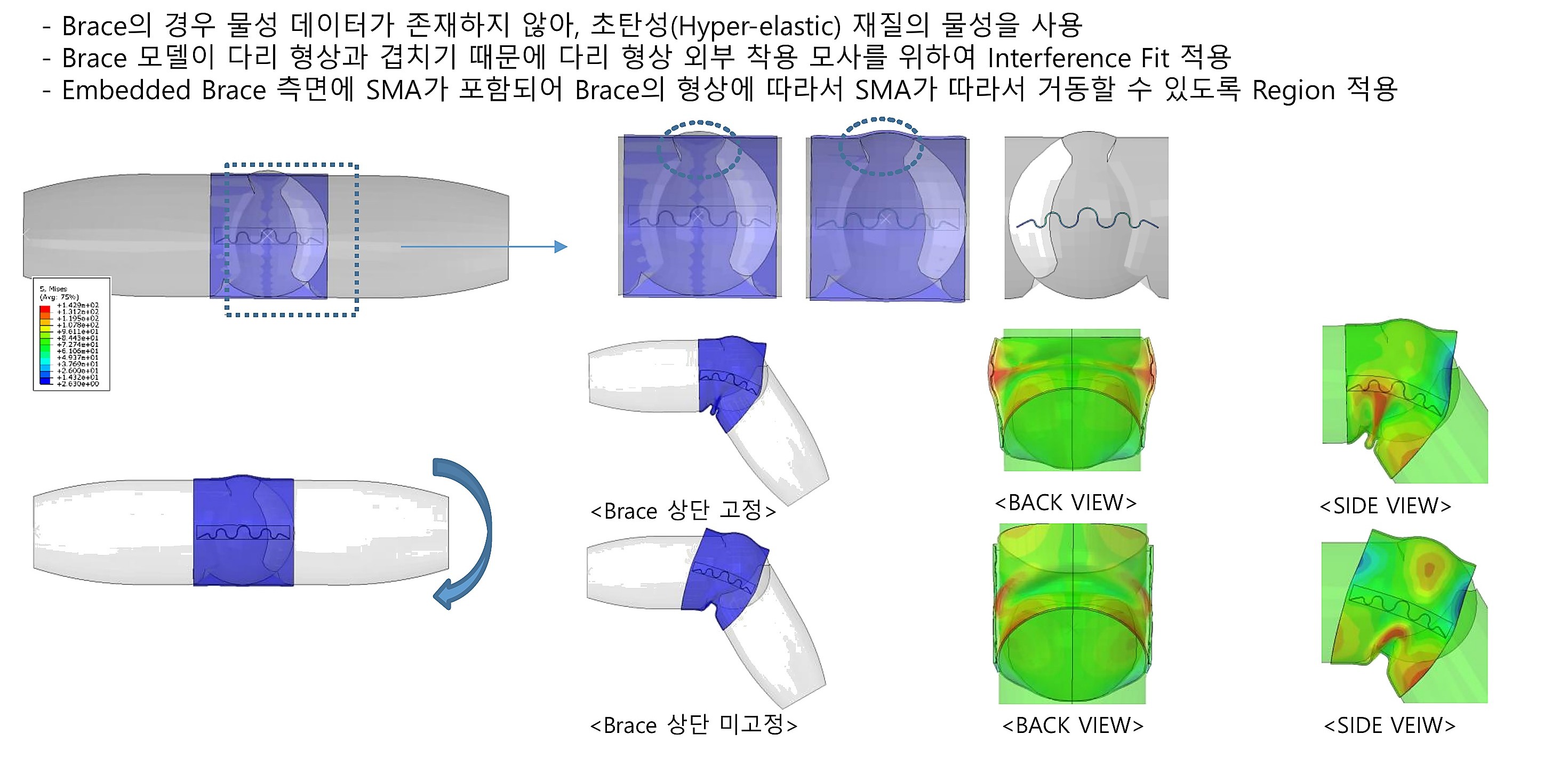 형상기억합금 무릎 보호 장치